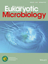 JOURNAL OF EUKARYOTIC MICROBIOLOGY杂志封面